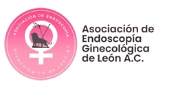 Sesión Mensual - Úteros de gran tamaño: estrategias para el éxito